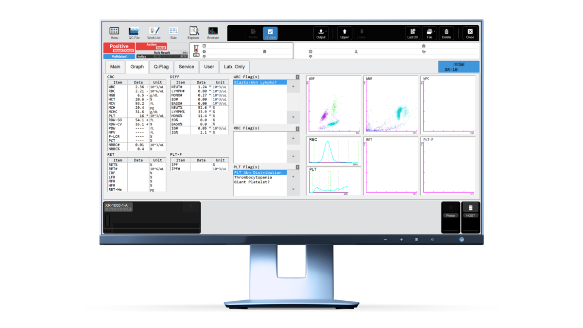 Fig.1 Haematology lab results displayed on the XR graphical screen.