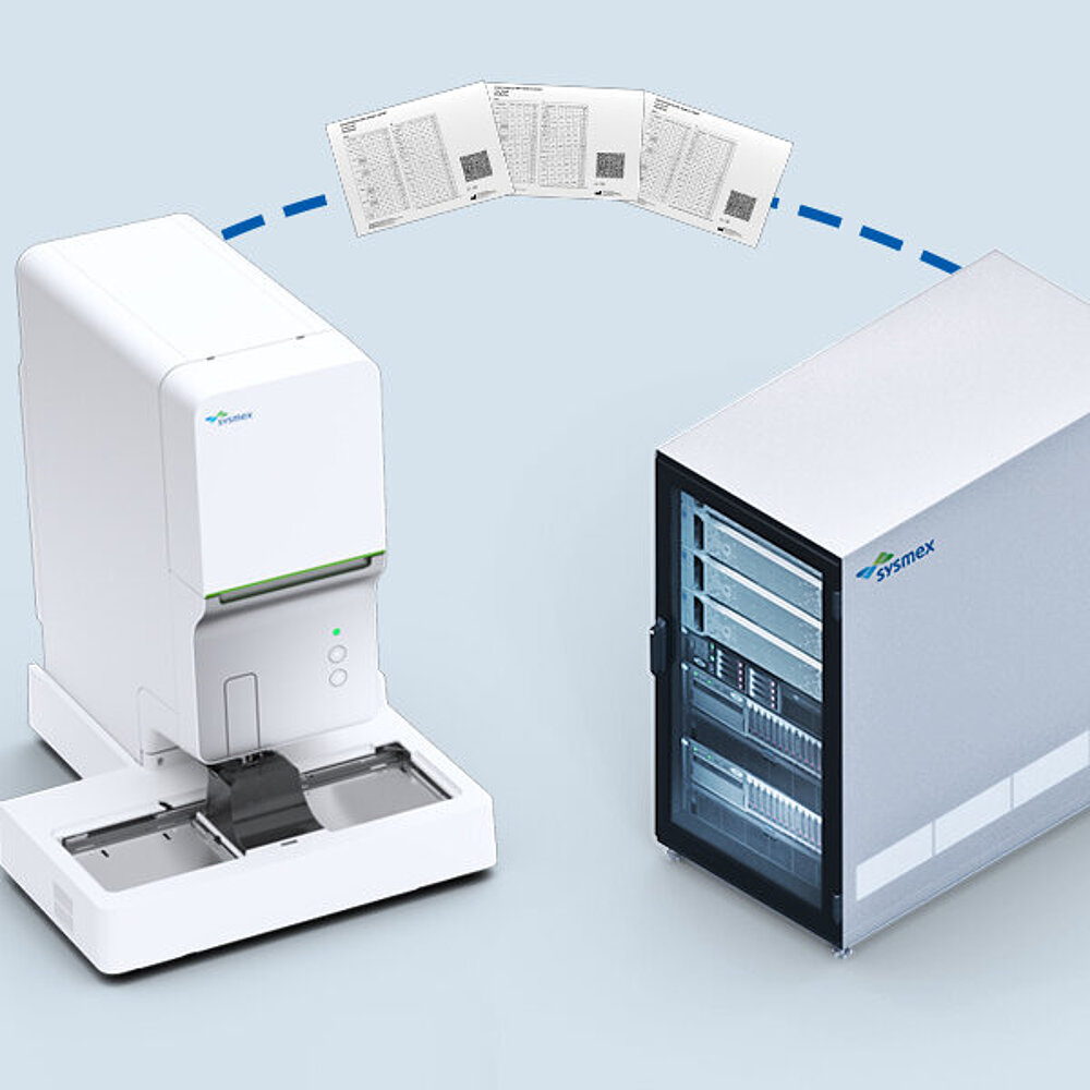 Automatisch downloaden van assaygegevens voor een gemakkelijke QC-ervaring