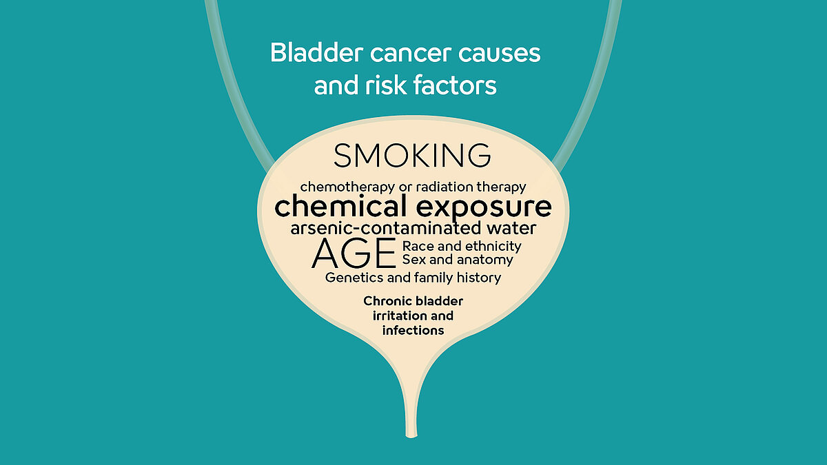 List of bladder cancer causes and risk factors, with the biggest risk factors being age and smoking