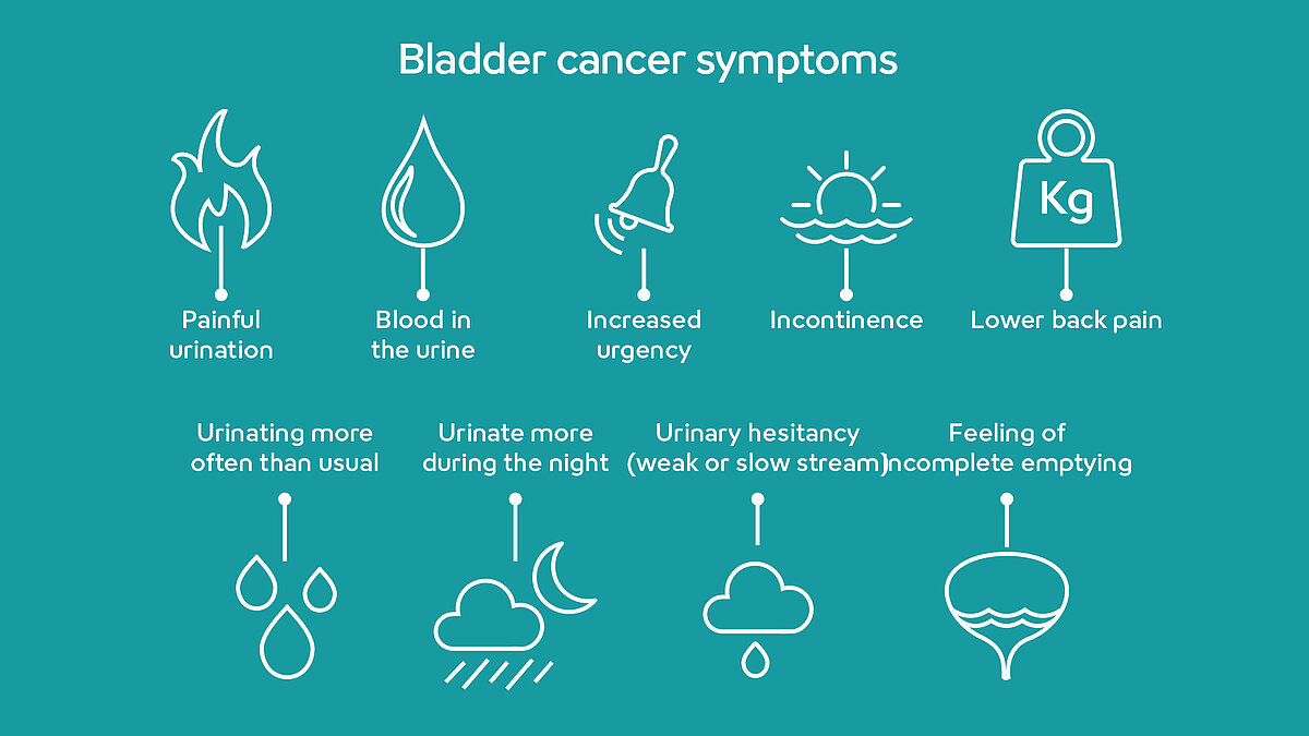 Description des symptômes du cancer de la vessie