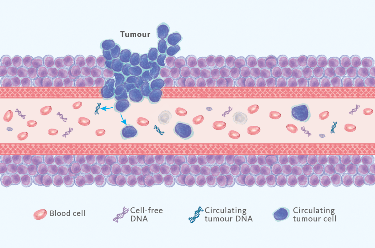 [.NL-en Netherlands (english)] Liquid biopsy