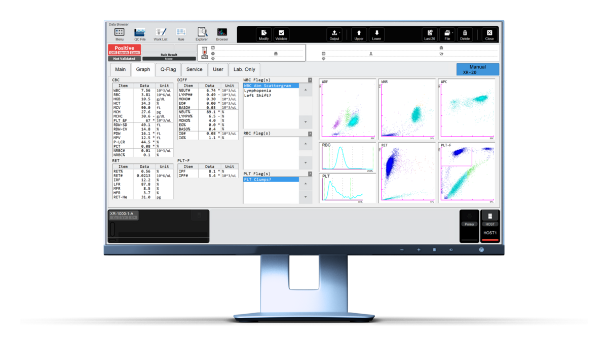 Fig. 1 Haematology lab results displayed by the XR-Series information-processing unit (IPU).