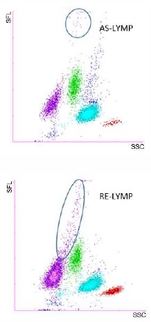 Scattergram AS-Lymp RE-Lymp