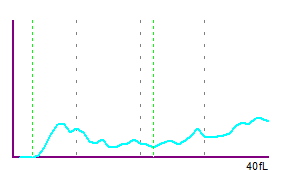 Fig. 2 PLT histogram showing an abnormal distribution.
