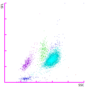 Fig. 2 WDF scattergram showing a neutrophil position shifted upwards and the presence of immature granulocytes (dark blue).