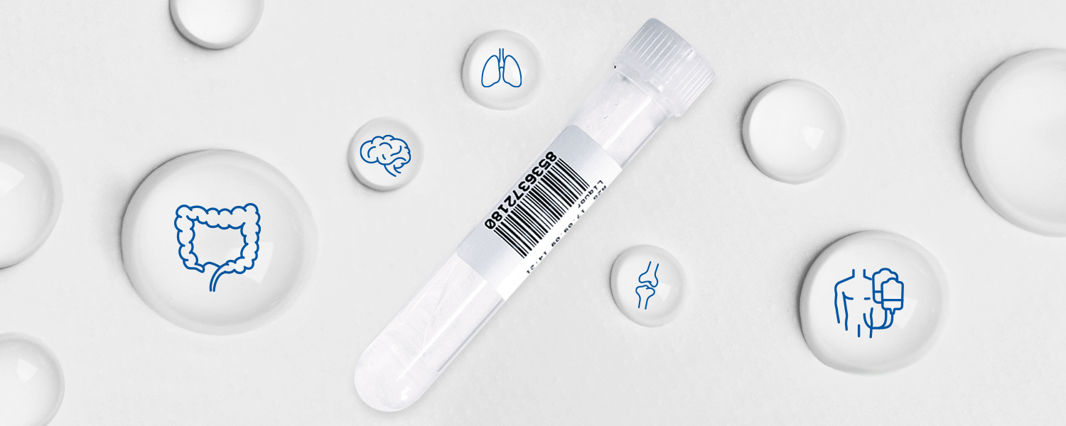 Intégrer l'analyse cellulaire des fluides corporels